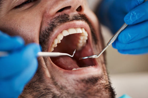 Best Tooth Infection Emergency Dentist  in Los Molinos, CA